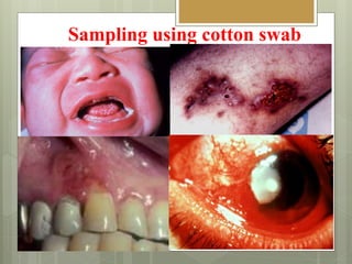 Sampling using cotton swab
 