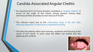 FUNGAL DISEASES in children by dr priyanka.pptx