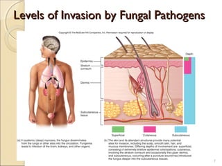 Levels of Invasion by Fungal PathogensLevels of Invasion by Fungal Pathogens
7
 