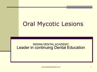 1
Oral Mycotic Lesions
INDIAN DENTAL ACADEMY
Leader in continuing Dental Education
www.indiandentalacademy.com
 