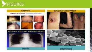FIGURES
SUPERFICIAL CUTANEOUS/ SUB-CUTANEOUS
SYSTEMIC OPPORTUNISTIC
 