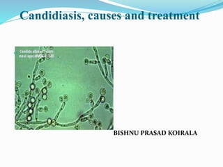 Candidiasis, causes and treatment

BISHNU PRASAD KOIRALA
 