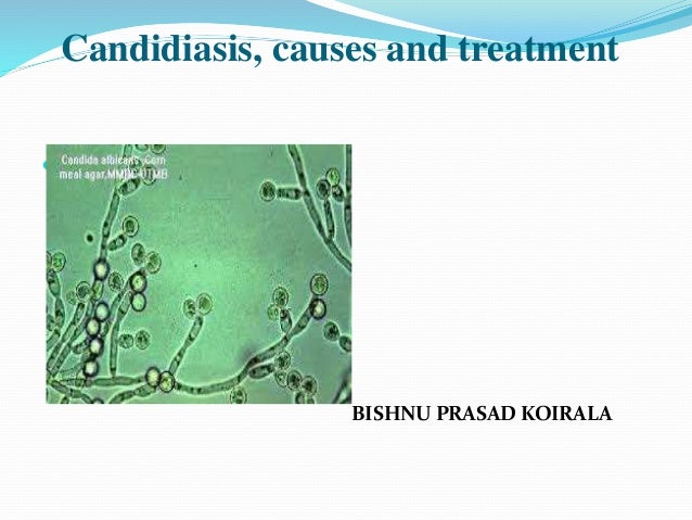 candida treatment