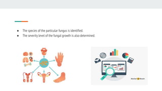 ● The species of the particular fungus is identified.
● The severity level of the fungal growth is also determined.
 