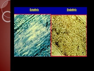 Fungal infection in hair | PPTX