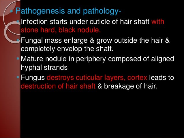 Fungal Infection In Hair