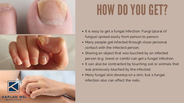 fungal infection on skin doctor near me