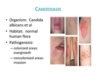 Fungal infections | PPTX