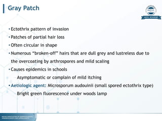 fungal infections for dermatology.pptx.pdf