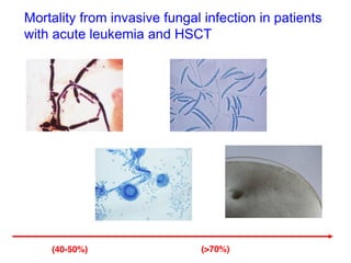 Fungal infections in hematology patients: advances in prophylaxis and ...