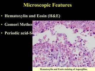 Microscopic Features

• Hematoxylin and Eosin (H&E)

• Gomori Methenamine Silver (GMS)

• Periodic acid-Schiff (PAS)




                     Hematoxylin and Eosin staining of Aspergillus.
 
