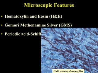 Microscopic Features

• Hematoxylin and Eosin (H&E)

• Gomori Methenamine Silver (GMS)

• Periodic acid-Schiff (PAS)




                               GMS staining of Aspergillus
 