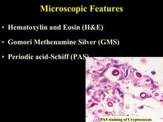 Microscopic Features

• Hematoxylin and Eosin (H&E)

• Gomori Methenamine Silver (GMS)

• Periodic acid-Schiff (PAS)




                               PAS staining of Cryptococcus
 