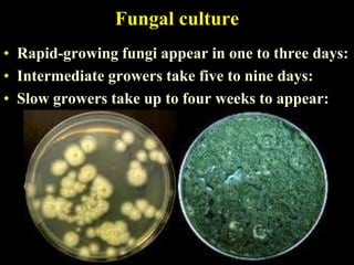Fungal culture
• Rapid-growing fungi appear in one to three days:
• Intermediate growers take five to nine days:
• Slow growers take up to four weeks to appear:
 