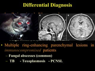 Differential Diagnosis
• locally invasive skull base neoplasm:
• Multiple ring-enhancing parenchymal lesions in
  immunocompetent patients:
  – Metastases    - Multiple pyogenic abscesses
  – TB     - Parasites (e.g., neurocysticercosis)
  – Fungal abscess (rare)        - Septic emboli
• Multiple ring-enhancing parenchymal lesions in
  immunocompromised patients
  – Fungal abscesses (common)
  – TB - Toxoplasmosis - PCNSL
 