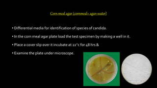 Corn meal agar (cornmeal+ agar+water)
• Differential media for identification of species of candida.
• In the corn meal agar plate load the test specimen by making a well in it.
• Place a cover slip over it incubate at 22°c for 48 hrs &
• Examine the plate under microscope.
 