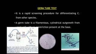 MORPHOLOGICAL CRITERIAGERM TUBE TEST
• It is a rapid screening procedure for differentiating C.
from other species.
• A germ tube is a filamentous, cylindrical outgrowth from
yeast cell with no constriction present at the base.
 