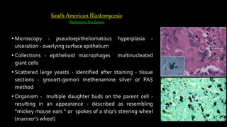 South American Blastomycosis
Blastomyces Brasiliensis
• Microscopy - pseudoepitheliomatous hyperplasia -
ulceration - overlying surface epithelium
• Collections - epithelioid macrophages multinucleated
giant cells
• Scattered large yeasts - identified after staining - tissue
sections - grocott-gomori methenamine silver or PAS
method
• Organism - multiple daughter buds on the parent cell -
resulting in an appearance - described as resembling
“mickey mouse ears “ or spokes of a ship’s steering wheel
(mariner’s wheel)
 
