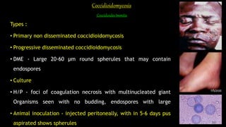 Coccidioidomycosis
Coccidioides Immitis
Types :
• Primary non disseminated coccidioidomycosis
• Progressive disseminated coccidioidomycosis
• DME - Large 20-60 µm round spherules that may contain
endospores
• Culture
• H/P - foci of coagulation necrosis with multinucleated giant
Organisms seen with no budding, endospores with large
• Animal inoculation - injected peritoneally, with in 5-6 days pus
aspirated shows spherules
 
