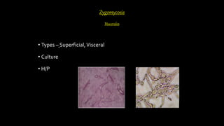 Zygomycosis
Mucorales
• Types – Superficial,Visceral
• Culture
• H/P
 