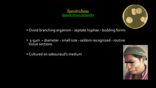Sporotrichosis
Sporotrichum Schenckii
• Ovoid branching organism - septate hyphae - budding forms
• 3-5µm – diameter - small size - seldom recognized - routine
tissue sections
• Cultured on sabouraud’s medium
 