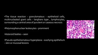 •The tissue reaction - granulomatous - epithelioid cells,
multinucleated giant cells - langhans type , lymphocytes,
surrounding a central area of purulent or caseous necrosis
•Polymorphonuclear leukocytes - prominent
•Asteroid bodies – seen
•Pseudo epitheliomatous hyperplasia - overlying epithelium
- skin or mucosal lesions
 
