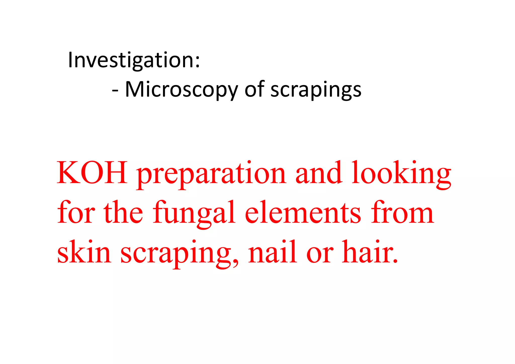 Investigation:
    - Microscopy of scrapings


KOH preparation and looking
for the fungal elements from
skin scraping, nail or hair.
 