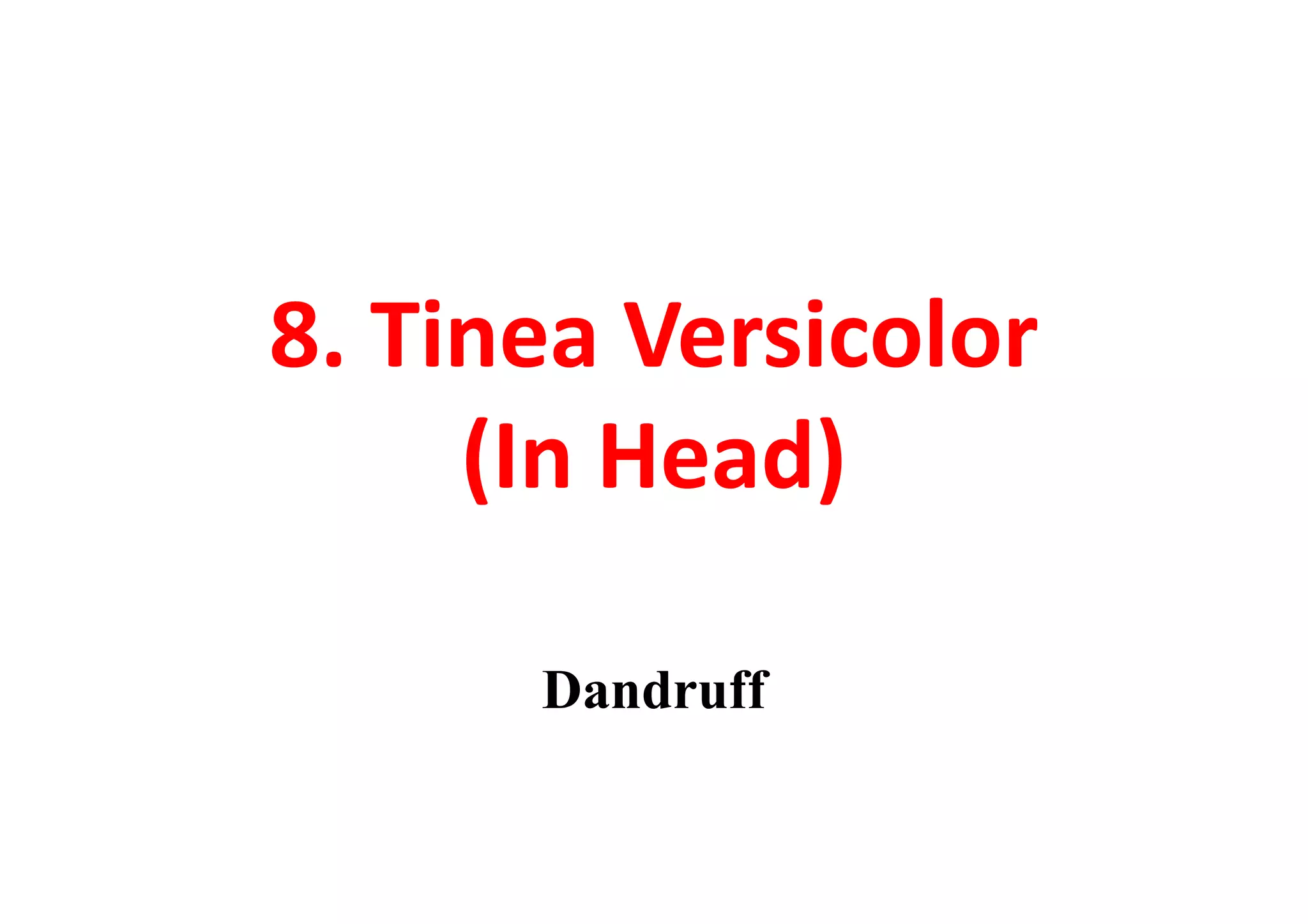 8. Tinea Versicolor
     (In Head)

      Dandruff
 