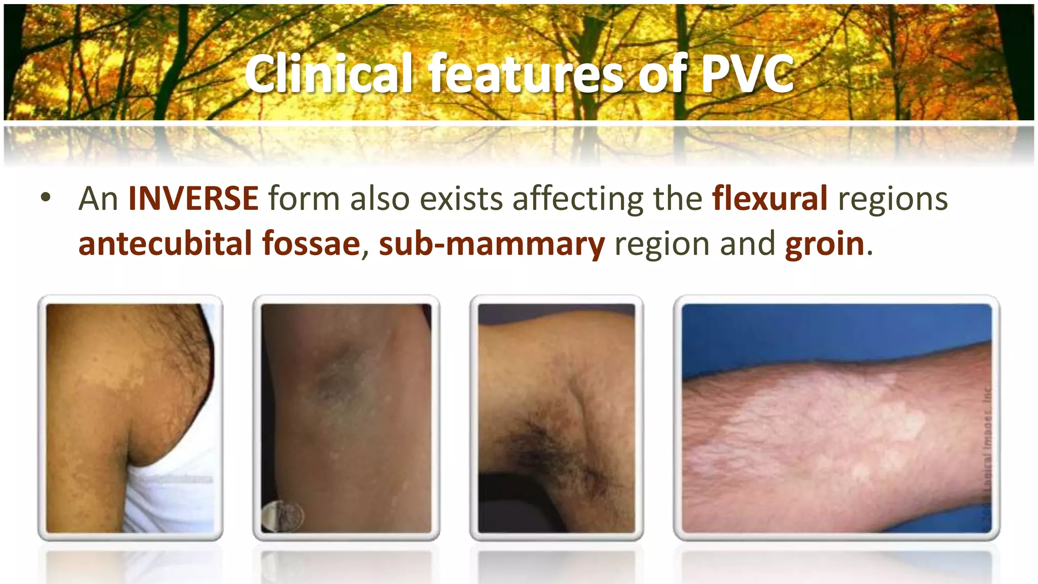 Fungal infections part I | PPTX