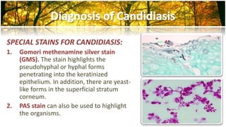 SPECIAL STAINS FOR CANDIDIASIS: 
1. Gomori methenamine silver stain 
(GMS). The stain highlights the 
pseudohyphal or hyphal forms 
penetrating into the keratinized 
epithelium. In addition, there are yeast-like 
forms in the superficial stratum 
corneum. 
2. PAS stain can also be used to highlight 
the organisms. 
 