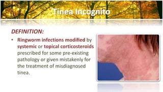 DEFINITION: 
• Ringworm infections modified by 
systemic or topical corticosteroids 
prescribed for some pre-existing 
pathology or given mistakenly for 
the treatment of misdiagnosed 
tinea. 
 