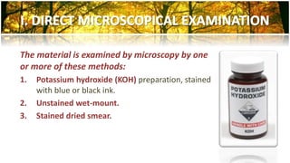 The material is examined by microscopy by one 
or more of these methods: 
1. Potassium hydroxide (KOH) preparation, stained 
with blue or black ink. 
2. Unstained wet-mount. 
3. Stained dried smear. 
 