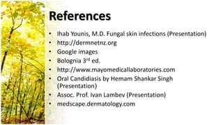 References 
• Ihab Younis, M.D. Fungal skin infections (Presentation) 
• http://dermnetnz.org 
• Google images 
• Bolognia 3rd ed. 
• http://www.mayomedicallaboratories.com 
• Oral Candidiasis by Hemam Shankar Singh 
)Presentation( 
• Assoc. Prof. Ivan Lambev (Presentation) 
• medscape.dermatology.com 
 