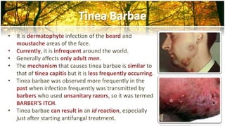 • It is dermatophyte infection of the beard and 
moustache areas of the face. 
• Currently, it is infrequent around the world. 
• Generally affects only adult men. 
• The mechanism that causes tinea barbae is similar to 
that of tinea capitis but it is less frequently occurring. 
• Tinea barbae was observed more frequently in the 
past when infection frequently was transmitted by 
barbers who used unsanitary razors, so it was termed 
BARBER'S ITCH. 
• Tinea barbae can result in an id reaction, especially 
just after starting antifungal treatment. 
 
