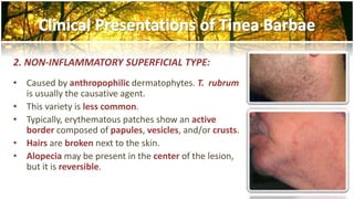 2. NON-INFLAMMATORY SUPERFICIAL TYPE: 
• Caused by anthropophilic dermatophytes. T. rubrum 
is usually the causative agent. 
• This variety is less common. 
• Typically, erythematous patches show an active 
border composed of papules, vesicles, and/or crusts. 
• Hairs are broken next to the skin. 
• Alopecia may be present in the center of the lesion, 
but it is reversible. 
 