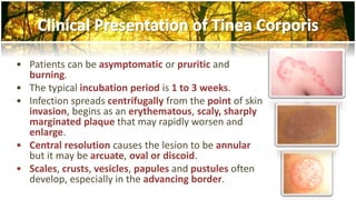 • Patients can be asymptomatic or pruritic and 
burning. 
• The typical incubation period is 1 to 3 weeks. 
• Infection spreads centrifugally from the point of skin 
invasion, begins as an erythematous, scaly, sharply 
marginated plaque that may rapidly worsen and 
enlarge. 
• Central resolution causes the lesion to be annular 
but it may be arcuate, oval or discoid. 
• Scales, crusts, vesicles, papules and pustules often 
develop, especially in the advancing border. 
 
