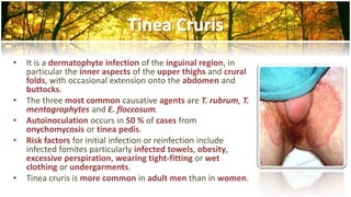 • It is a dermatophyte infection of the inguinal region, in 
particular the inner aspects of the upper thighs and crural 
folds, with occasional extension onto the abdomen and 
buttocks. 
• The three most common causative agents are T. rubrum, T. 
mentagrophytes and E. floccosum. 
• Autoinoculation occurs in 50 % of cases from 
onychomycosis or tinea pedis. 
• Risk factors for initial infection or reinfection include 
infected fomites particularly infected towels, obesity, 
excessive perspiration, wearing tight-fitting or wet 
clothing or undergarments. 
• Tinea cruris is more common in adult men than in women. 
 