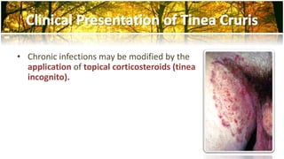 • Chronic infections may be modified by the 
application of topical corticosteroids (tinea 
incognito). 
 