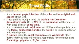 • It is a dermatophyte infection of the soles and interdigital web 
spaces of the feet. 
• Tinea pedis is thought to be the world's most common 
dermatophytosis. Up to 70% of the population will be infected 
with tinea pedis at some time. 
• It is more common in adult men as childhood tinea pedis is rare. 
• The lack of sebaceous glands in the soles is an important factor 
in its development. 
• T. rubrum being the most common cause worldwide other 
dermatophytes that are typically responsible for tinea pedis are 
T. mentagrophytes and E. floccosum. 
 
