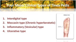1. Interdigital type 
2. Moccasin type (Chronic hyperkeratotic) 
3. Inflammatory (Vesicular) type 
4. Ulcerative type 
 