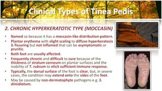 2. CHRONIC HYPERKERATOTIC TYPE (MOCCASIN) 
• Named so because it has a moccasin-like distribution pattern. 
• Plantar erythema with slight scaling to diffuse hyperkeratosis 
& fissuring but not inflamed that can be asymptomatic or 
pruritic. 
• Both feet are usually affected. 
• Frequently chronic and difficult to cure because of the 
thickness of stratum corneum on plantar surfaces and the 
inability of T. rubrum to elicit sufficient immune response. 
• Typically, the dorsal surface of the foot is clear, but, in severe 
cases, the condition may extend onto the sides of the foot. 
• May be caused by non-dermatophyte pathogens e.g. S. 
dimidiatum. 
 