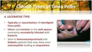 4. ULCERATIVE TYPE: 
• Typically an exacerbation of interdigital 
tinea pedis. 
• Ulcers and erosions in the web spaces; 
commonly secondarily infected with 
bacteria. 
• Seen in immunocompromised and 
diabetic patients that may show even 
osteomyelitis leading to amputation. 
 