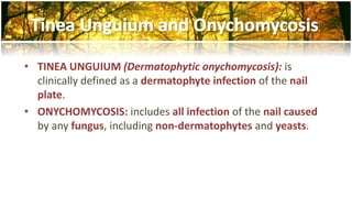 • TINEA UNGUIUM (Dermatophytic onychomycosis): is 
clinically defined as a dermatophyte infection of the nail 
plate. 
• ONYCHOMYCOSIS: includes all infection of the nail caused 
by any fungus, including non-dermatophytes and yeasts. 
 