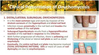 1. DISTAL/LATERAL SUBUNGUAL ONYCHOMYCOSIS: 
• It is the most common type and starts by invasion of the 
stratum corneum of the hyponychium and distal nail bed. 
• Infection moves proximally in the nail bed and invades the 
ventral surface of the nail plate. 
• Subungual hyperkeratosis results from a hyperproliferative 
reaction of the nail bed in response to the infection. 
• With further progression of infection, there is yellowing and 
thickening of the distal or lateral nail plate as well as distal 
onycholysis. 
• Eventually, the entire nail bed and plate may become involved 
(TOTAL DYSTROPHIC PATTERN). 50% or more of cases of nail 
dystrophy are due to onychomycosis. 
 