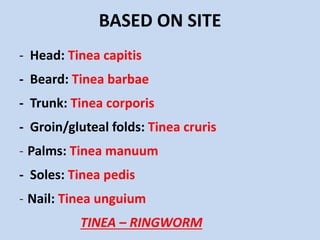 BASED ON SITE
- Head: Tinea capitis
- Beard: Tinea barbae
- Trunk: Tinea corporis
- Groin/gluteal folds: Tinea cruris
- Palms: Tinea manuum
- Soles: Tinea pedis
- Nail: Tinea unguium
TINEA – RINGWORM
 