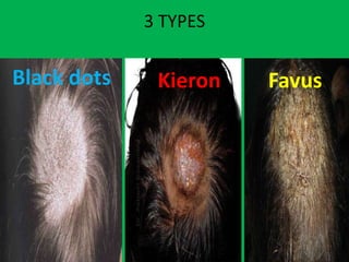 3 TYPES
Black dots Kieron Favus
 