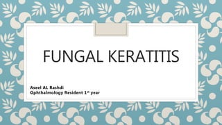 FUNGAL KERATITIS
Aseel AL Rashdi
Ophthalmology Resident 1st year
 