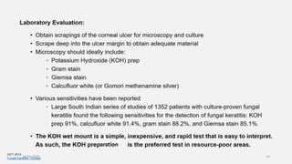 aration
OCT 2014
Fungal Keratitis - Europe26-06-2020 14
 