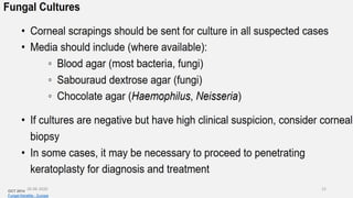 OCT 2014
Fungal Keratitis - Europe
26-06-2020 15
 