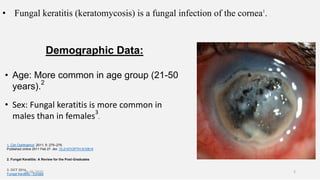 • Fungal keratitis (keratomycosis) is a fungal infection of the cornea1
.
1. Clin Ophthalmol. 2011; 5: 275–279.
Published online 2011 Feb 27. doi: 10.2147/OPTH.S10819
Demographic Data:
• Age: More common in age group (21-50
years).
2
• Sex: Fungal keratitis is more common in
males than in females
3
.
2. Fungal Keratitis: A Review for the Post-Graduates
3. OCT 2014
Fungal Keratitis - Europe
26-06-2020 2
 